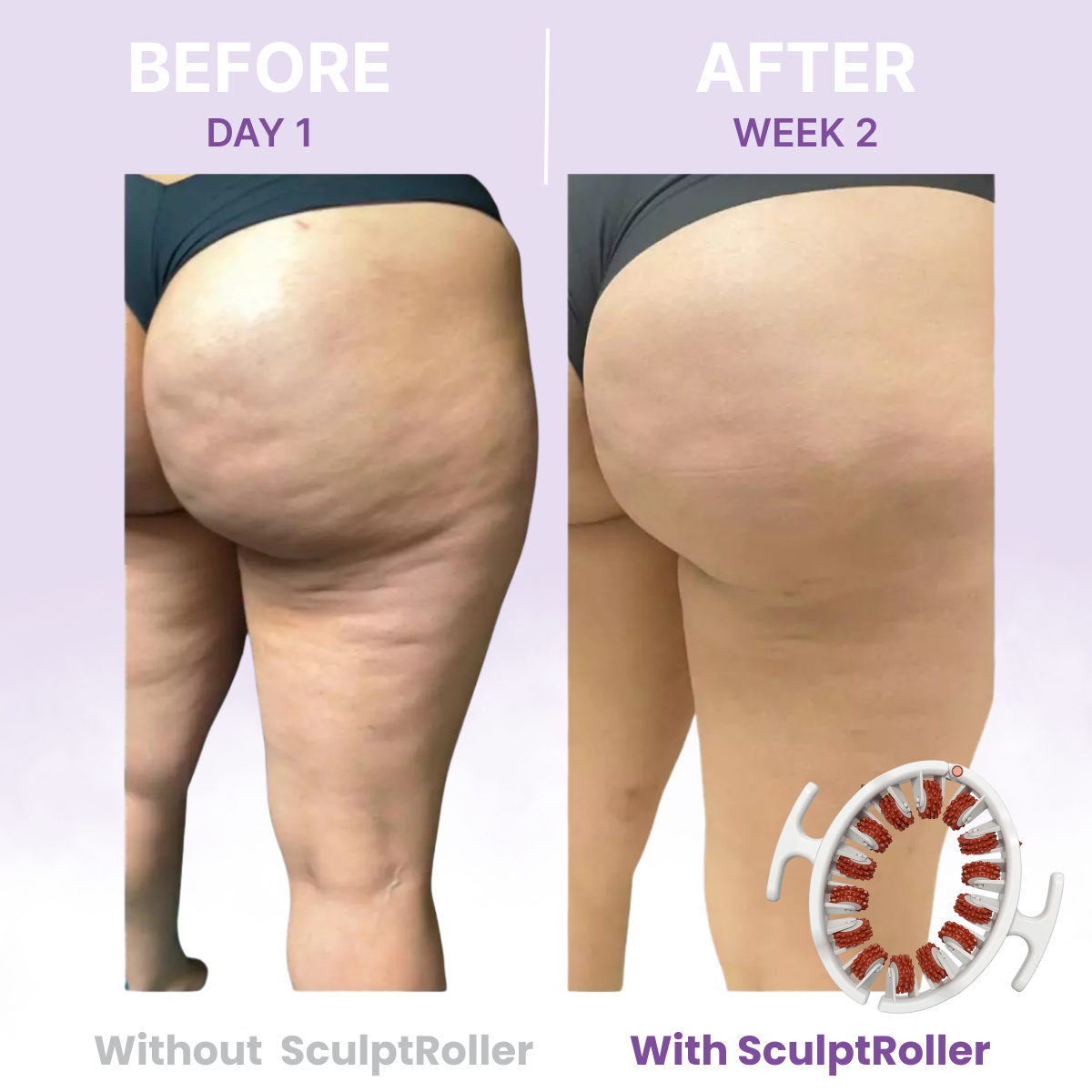 SculptRoller